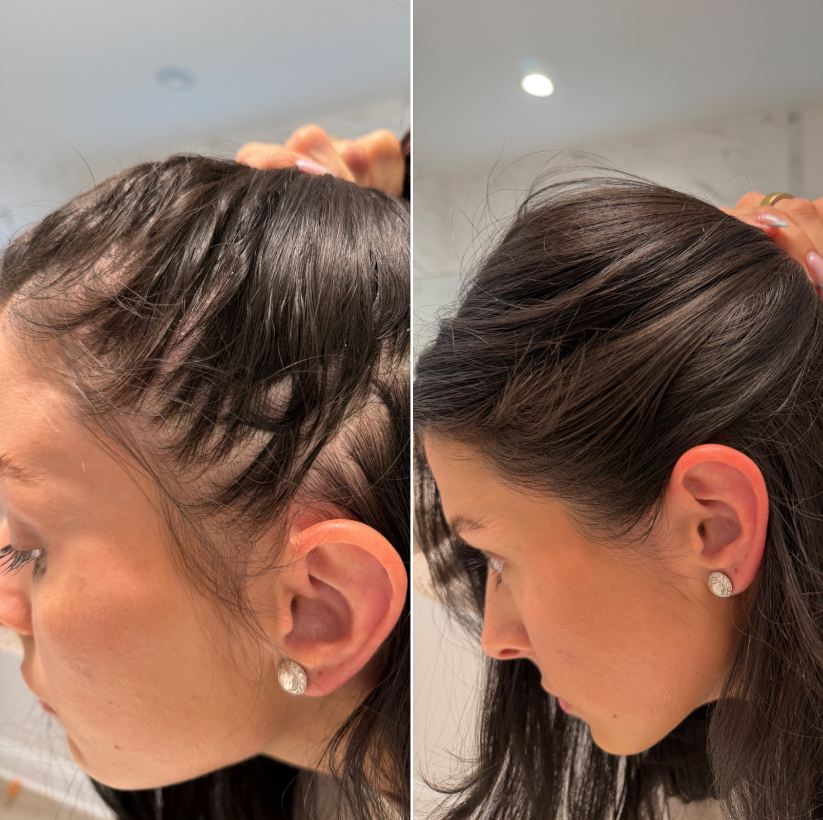 Density Intensive Treatment